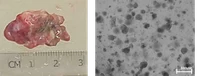 Tumor tissue and tumor organoids generated from the tumor tissue